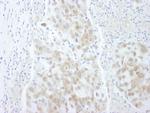 4EBP1 Antibody in Immunohistochemistry (Paraffin) (IHC (P))