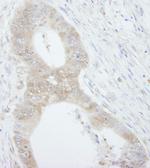 4EBP1 Antibody in Immunohistochemistry (Paraffin) (IHC (P))