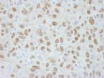 DDB1 Polyclonal Antibody