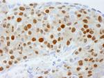DDB1 Antibody in Immunohistochemistry (Paraffin) (IHC (P))