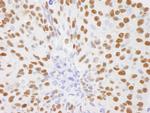 DBC1/p30 DBC Antibody in Immunohistochemistry (Paraffin) (IHC (P))