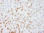 DBC1/p30 DBC Polyclonal Antibody