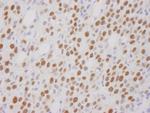 CoREST Antibody in Immunohistochemistry (Paraffin) (IHC (P))