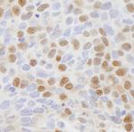 CSE1 Antibody in Immunohistochemistry (Paraffin) (IHC (P))