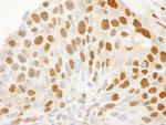 CRM1 Antibody in Immunohistochemistry (Paraffin) (IHC (P))