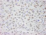 CRM1 Polyclonal Antibody