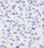 SMAR1/BANP Polyclonal Antibody