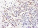 REST Antibody in Immunohistochemistry (Paraffin) (IHC (P))
