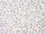 TIF1 Alpha/TRIM24 Antibody in Immunohistochemistry (Paraffin) (IHC (P))