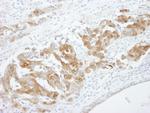 CRABP2 Antibody in Immunohistochemistry (Paraffin) (IHC (P))
