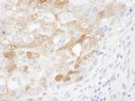 CRABP2 Antibody in Immunohistochemistry (Paraffin) (IHC (P))