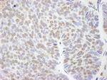 UBCH7 Polyclonal Antibody
