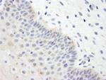 UBCH7 Antibody in Immunohistochemistry (Paraffin) (IHC (P))