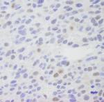 MED1 Polyclonal Antibody