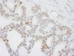 DDX24 Antibody in Immunohistochemistry (Paraffin) (IHC (P))