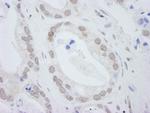 DDX24 Polyclonal Antibody