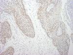 DDX21 Polyclonal Antibody