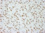 DDX21 Antibody in Immunohistochemistry (Paraffin) (IHC (P))