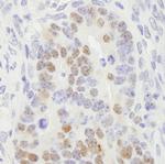 RCC2 Antibody in Immunohistochemistry (Paraffin) (IHC (P))