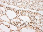 RCC2 Polyclonal Antibody