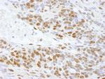 DDX5 Antibody in Immunohistochemistry (Paraffin) (IHC (P))