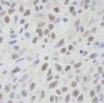 DHX9 Antibody in Immunohistochemistry (Paraffin) (IHC (P))