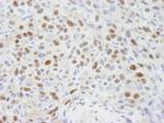 RbBP7 Polyclonal Antibody