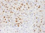 EFTUD2/SNRP116 Antibody in Immunohistochemistry (Paraffin) (IHC (P))
