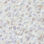 PPM1G Antibody in Immunohistochemistry (Paraffin) (IHC (P))