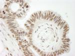 Topo II Beta Antibody in Immunohistochemistry (Paraffin) (IHC (P))