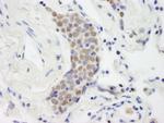 Topo II Beta Polyclonal Antibody