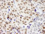 ZNF261 Polyclonal Antibody