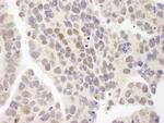 ZNF261 Antibody in Immunohistochemistry (Paraffin) (IHC (P))