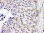 IRF3 Antibody in Immunohistochemistry (Paraffin) (IHC (P))