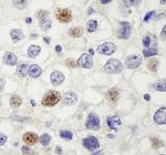 HURP/DLG7 Antibody in Immunohistochemistry (Paraffin) (IHC (P))