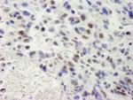 hSET1 Antibody in Immunohistochemistry (Paraffin) (IHC (P))