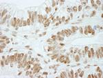 RbBP5 Antibody in Immunohistochemistry (Paraffin) (IHC (P))