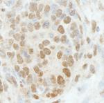 RbBP5 Antibody in Immunohistochemistry (Paraffin) (IHC (P))