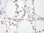 CSN2 Polyclonal Antibody