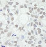 MED12 Polyclonal Antibody