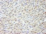 MED18 Antibody in Immunohistochemistry (Paraffin) (IHC (P))