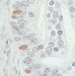 MED18 Polyclonal Antibody