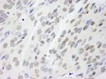NONO Antibody in Immunohistochemistry (Paraffin) (IHC (P))