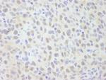 NCOA62 Polyclonal Antibody