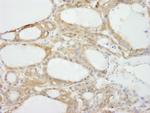 NF2 Antibody in Immunohistochemistry (Paraffin) (IHC (P))