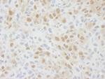 NIF1 Antibody in Immunohistochemistry (Paraffin) (IHC (P))