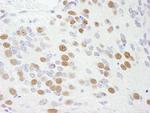 RBM9 Antibody in Immunohistochemistry (Paraffin) (IHC (P))