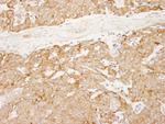 Reticulocalbin-1 Antibody in Immunohistochemistry (Paraffin) (IHC (P))