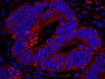 Reticulocalbin-1 Polyclonal Antibody