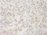 SUPT5H Antibody in Immunohistochemistry (Paraffin) (IHC (P))